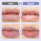 🔥COMPRAR 1 OBTENER 1 GRATIS🔥|Suero labial hidratante antiarrugas y voluminizador💧💋